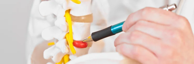 Burnsville MN Chiropractor Talks about Bulging Discs